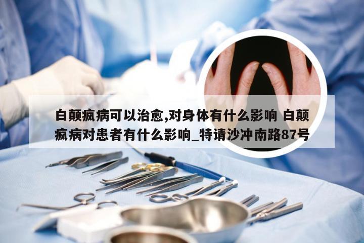 白颠疯病可以治愈,对身体有什么影响 白颠疯病对患者有什么影响_特请沙冲南路87号