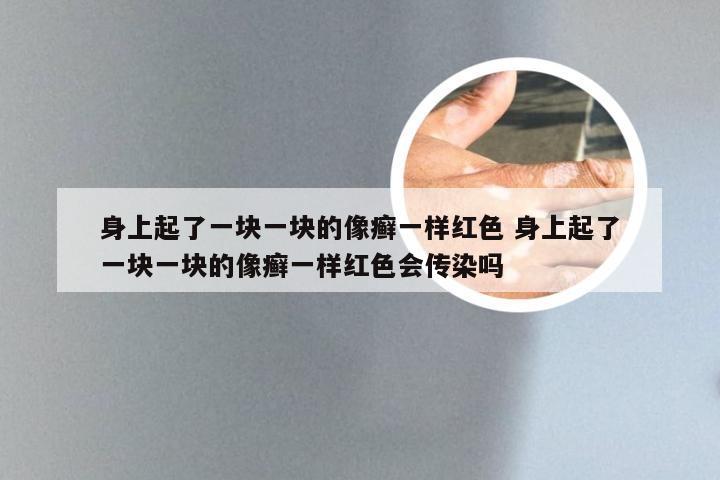 身上起了一块一块的像癣一样红色 身上起了一块一块的像癣一样红色会传染吗