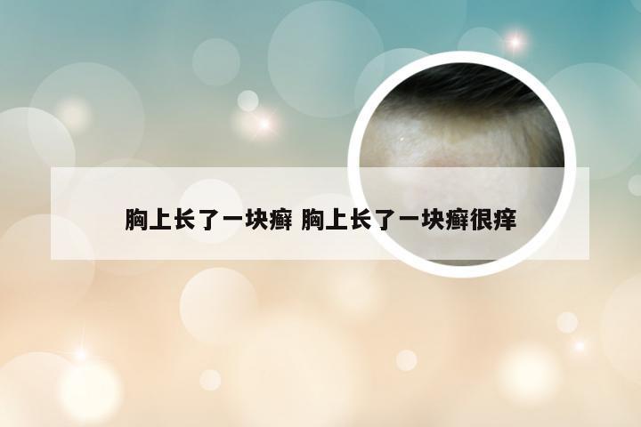 胸上长了一块癣 胸上长了一块癣很痒