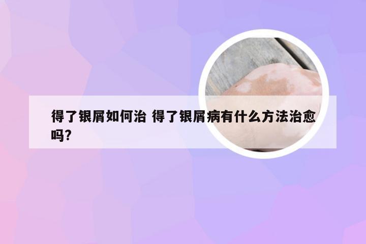 得了银屑如何治 得了银屑病有什么方法治愈吗?