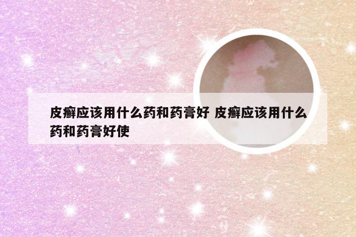 皮癣应该用什么药和药膏好 皮癣应该用什么药和药膏好使