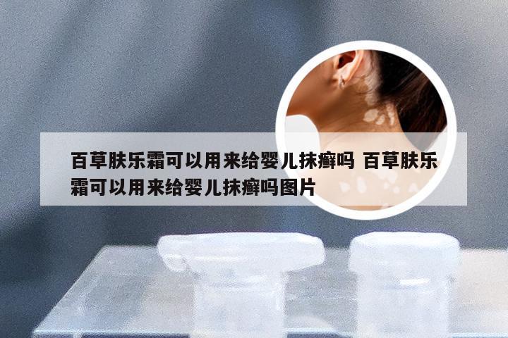 百草肤乐霜可以用来给婴儿抹癣吗 百草肤乐霜可以用来给婴儿抹癣吗图片
