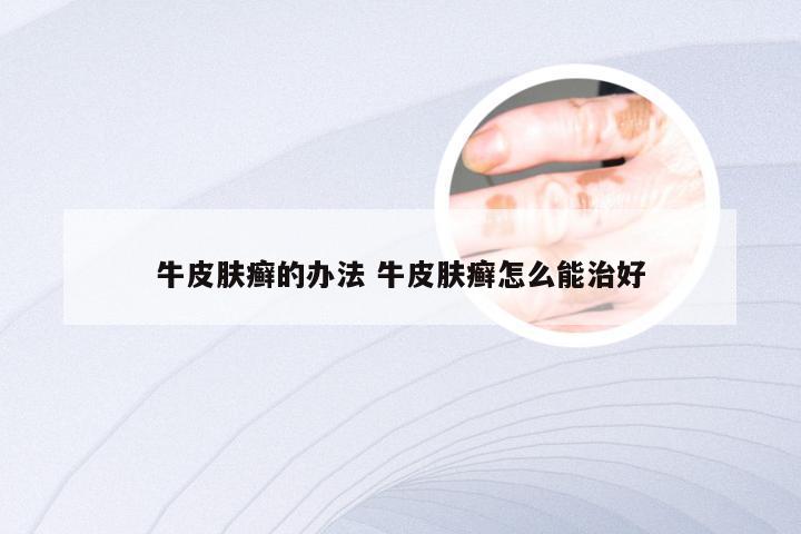 牛皮肤癣的办法 牛皮肤癣怎么能治好