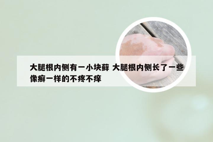 大腿根内侧有一小块藓 大腿根内侧长了一些像癣一样的不疼不痒