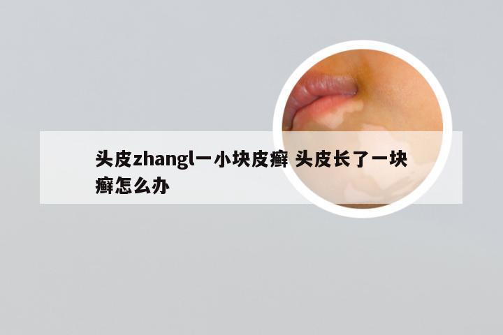 头皮zhangl一小块皮癣 头皮长了一块癣怎么办