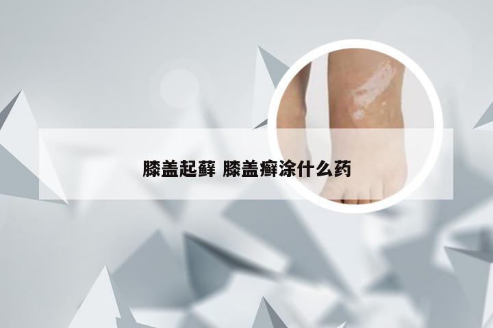 膝盖起藓 膝盖癣涂什么药