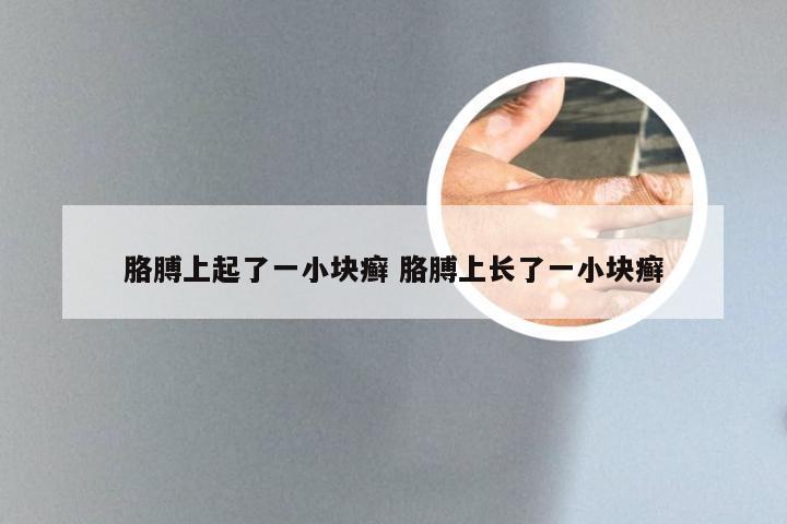 胳膊上起了一小块癣 胳膊上长了一小块癣