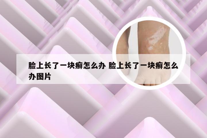 脸上长了一块癣怎么办 脸上长了一块癣怎么办图片