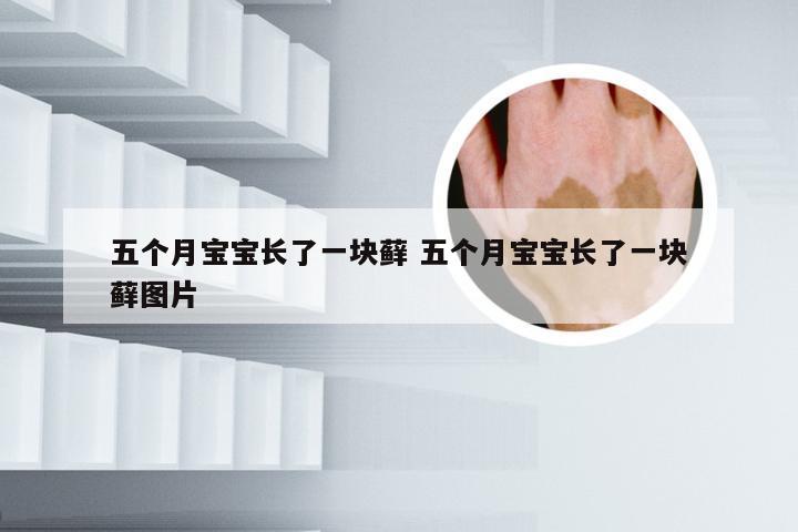 五个月宝宝长了一块藓 五个月宝宝长了一块藓图片