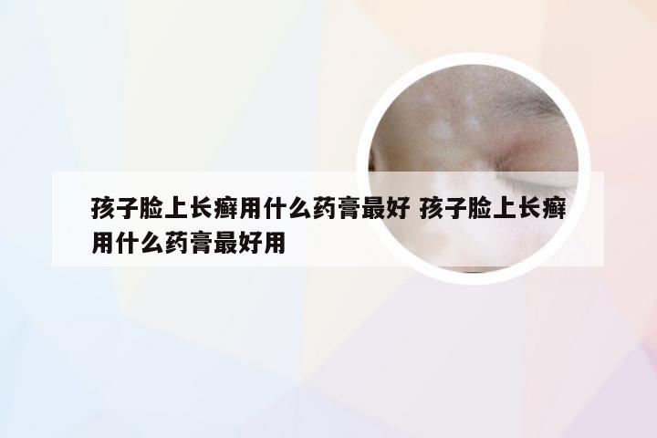 孩子脸上长癣用什么药膏最好 孩子脸上长癣用什么药膏最好用