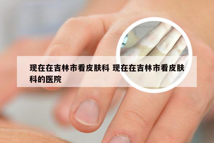 现在在吉林市看皮肤科 现在在吉林市看皮肤科的医院