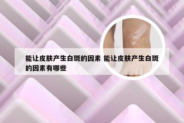 能让皮肤产生白斑的因素 能让皮肤产生白斑的因素有哪些
