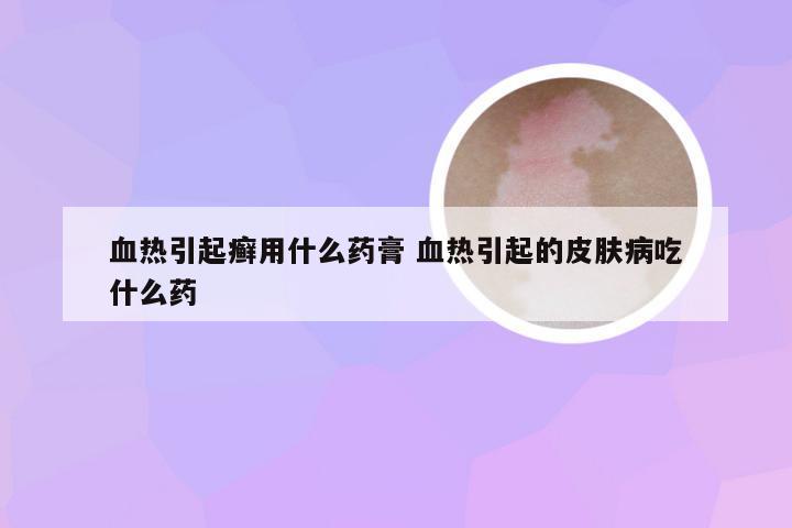 血热引起癣用什么药膏 血热引起的皮肤病吃什么药
