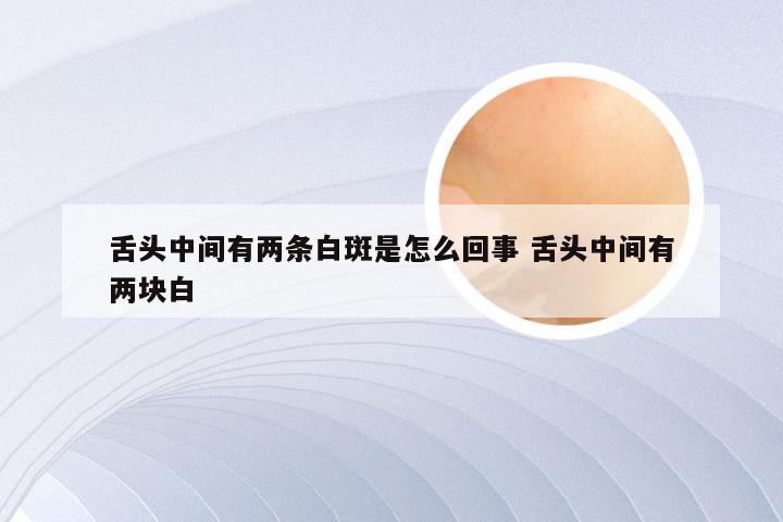 舌头中间有两条白斑是怎么回事 舌头中间有两块白