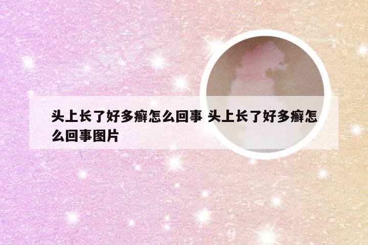 头上长了好多癣怎么回事 头上长了好多癣怎么回事图片