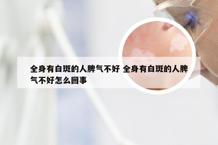 全身有白斑的人脾气不好 全身有白斑的人脾气不好怎么回事