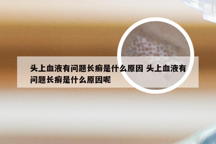头上血液有问题长癣是什么原因 头上血液有问题长癣是什么原因呢