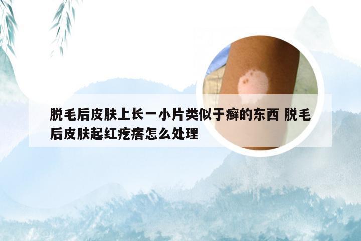 脱毛后皮肤上长一小片类似于癣的东西 脱毛后皮肤起红疙瘩怎么处理