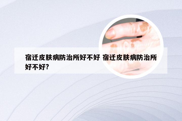 宿迁皮肤病防治所好不好 宿迁皮肤病防治所好不好?