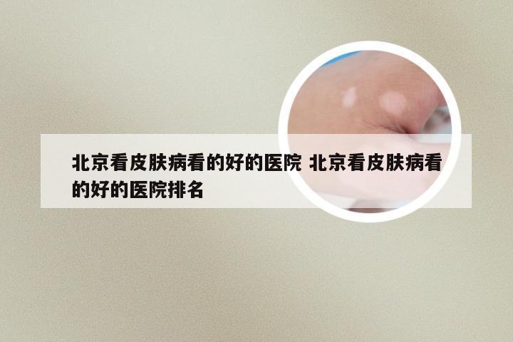 北京看皮肤病看的好的医院 北京看皮肤病看的好的医院排名