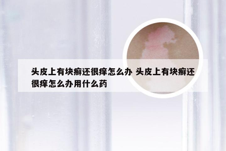 头皮上有块癣还很痒怎么办 头皮上有块癣还很痒怎么办用什么药