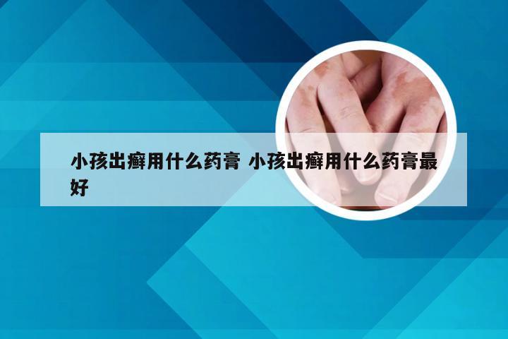 小孩出癣用什么药膏 小孩出癣用什么药膏最好