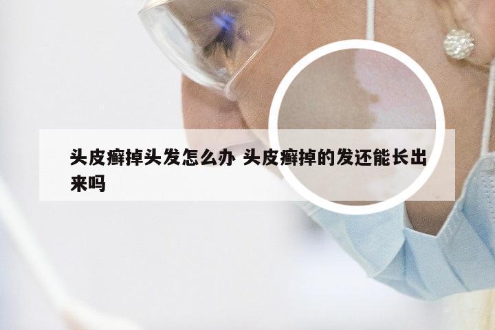 头皮癣掉头发怎么办 头皮癣掉的发还能长出来吗
