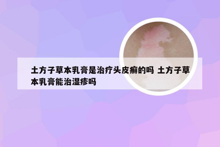土方子草本乳膏是治疗头皮癣的吗 土方子草本乳膏能治湿疹吗