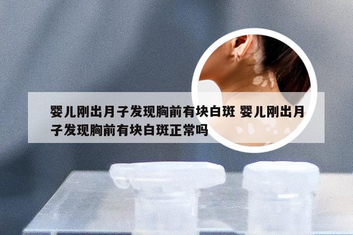 婴儿刚出月子发现胸前有块白斑 婴儿刚出月子发现胸前有块白斑正常吗