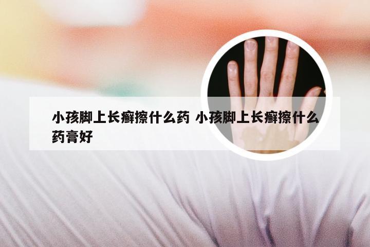 小孩脚上长癣擦什么药 小孩脚上长癣擦什么药膏好