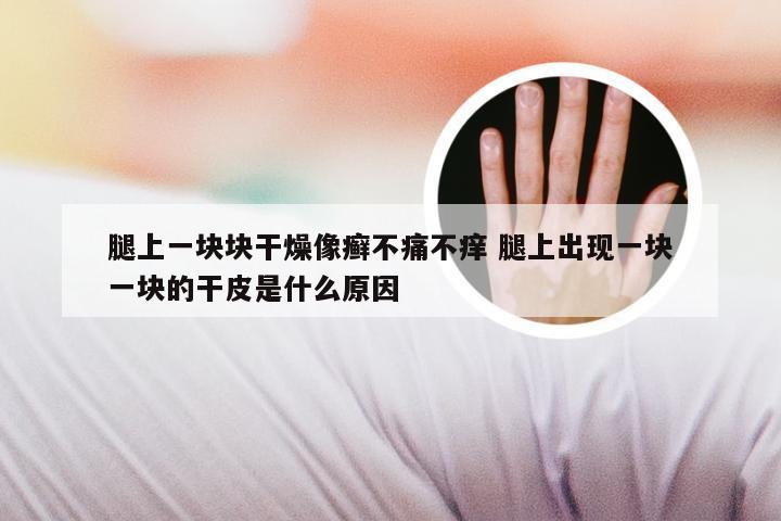 腿上一块块干燥像癣不痛不痒 腿上出现一块一块的干皮是什么原因