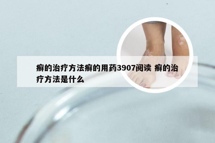 癣的治疗方法癣的用药3907阅读 癣的治疗方法是什么