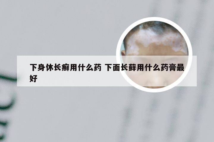 下身休长癣用什么药 下面长藓用什么药膏最好