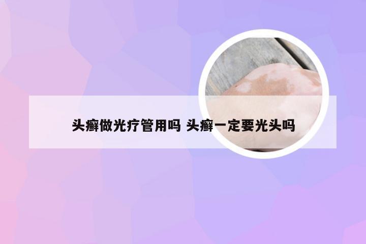 头癣做光疗管用吗 头癣一定要光头吗