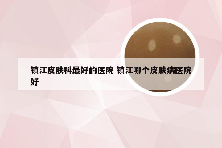 镇江皮肤科最好的医院 镇江哪个皮肤病医院好