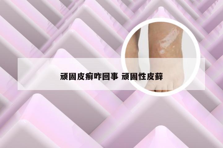 顽固皮癣咋回事 顽固性皮藓