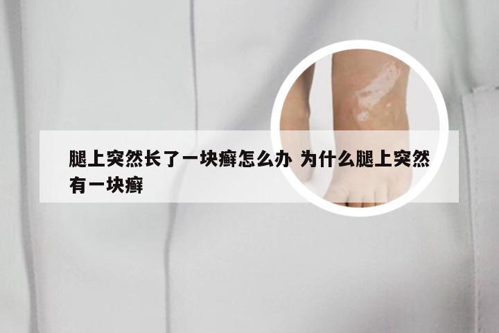 腿上突然长了一块癣怎么办 为什么腿上突然有一块癣