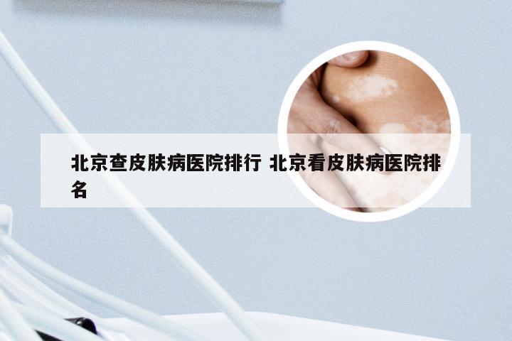 北京查皮肤病医院排行 北京看皮肤病医院排名
