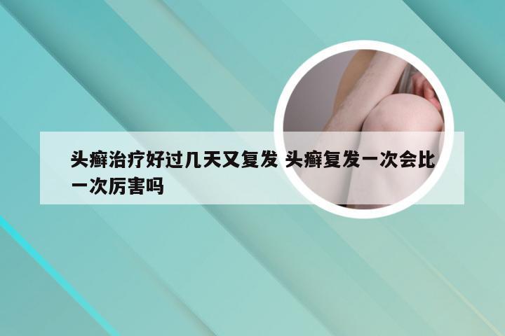 头癣治疗好过几天又复发 头癣复发一次会比一次厉害吗
