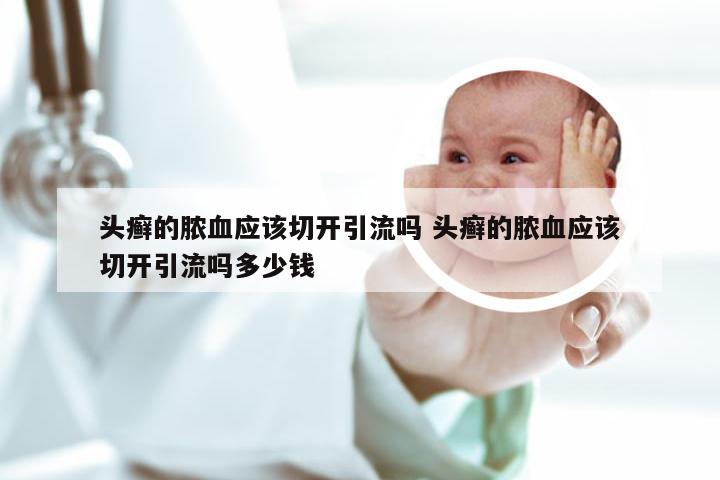 头癣的脓血应该切开引流吗 头癣的脓血应该切开引流吗多少钱