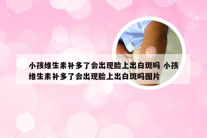小孩维生素补多了会出现脸上出白斑吗 小孩维生素补多了会出现脸上出白斑吗图片
