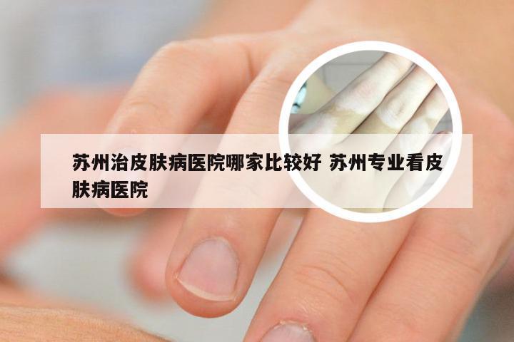 苏州治皮肤病医院哪家比较好 苏州专业看皮肤病医院