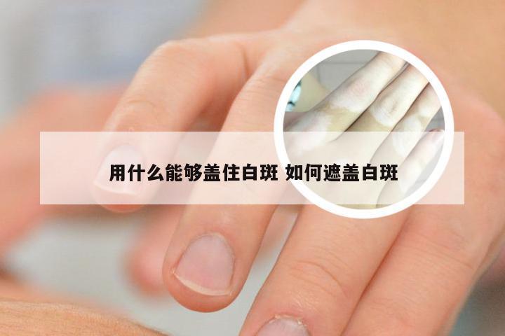 用什么能够盖住白斑 如何遮盖白斑