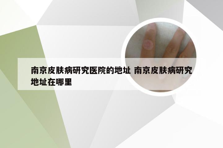 南京皮肤病研究医院的地址 南京皮肤病研究地址在哪里