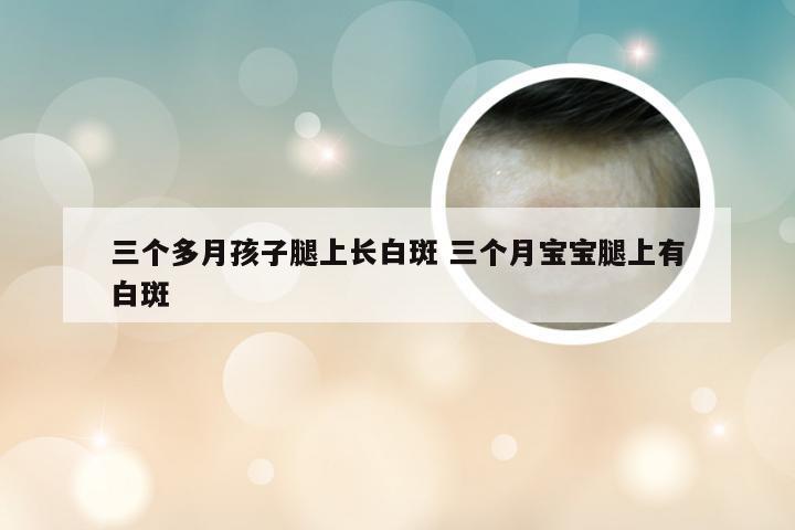 三个多月孩子腿上长白斑 三个月宝宝腿上有白斑