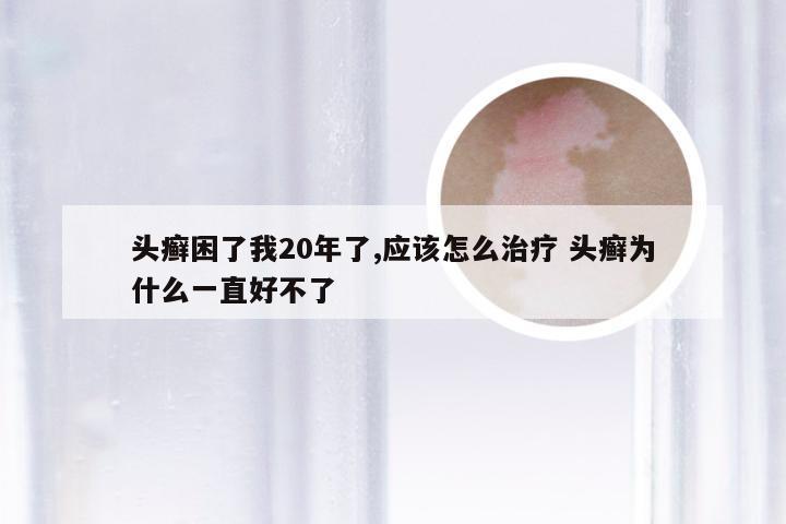 头癣困了我20年了,应该怎么治疗 头癣为什么一直好不了