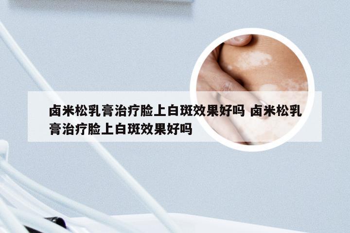 卤米松乳膏治疗脸上白斑效果好吗 卤米松乳膏治疗脸上白斑效果好吗