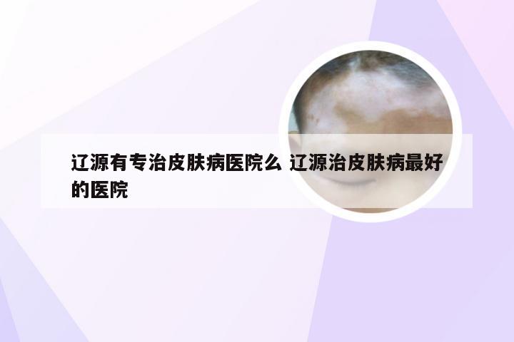 辽源有专治皮肤病医院么 辽源治皮肤病最好的医院