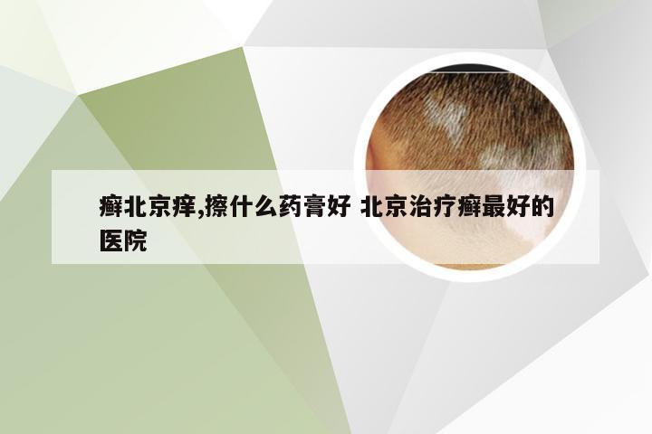 癣北京痒,擦什么药膏好 北京治疗癣最好的医院