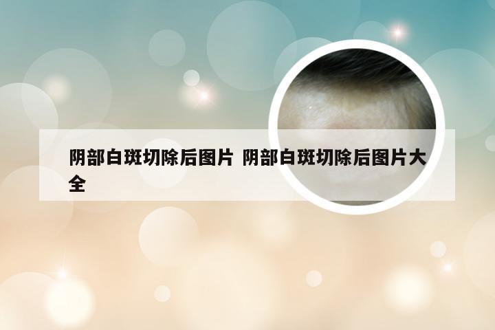 阴部白斑切除后图片 阴部白斑切除后图片大全
